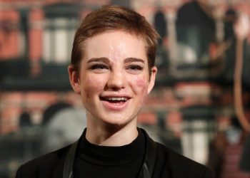 Borsa rubata, appello Bebe Vio “Ridatemi la tesi di laurea”