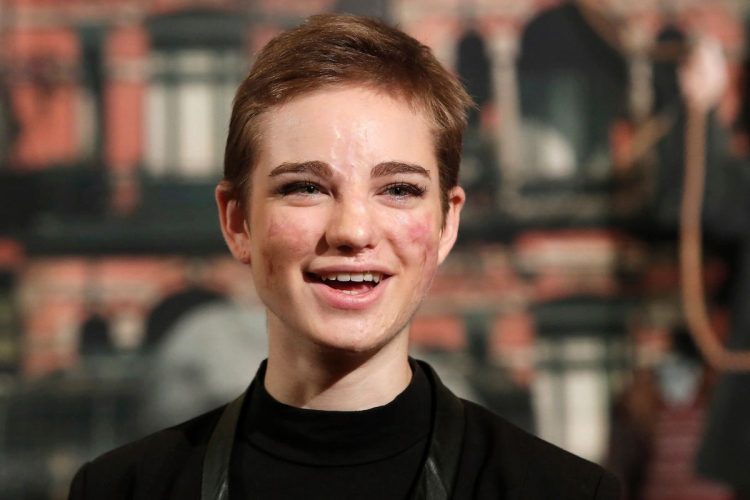 Borsa rubata, appello Bebe Vio “Ridatemi la tesi di laurea”