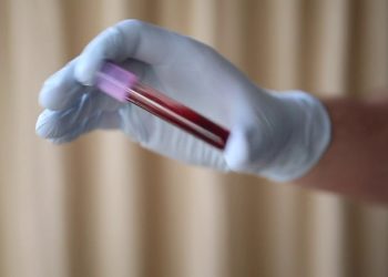 Leucemie pediatriche, ecco quali sintomi devono farci preoccupare