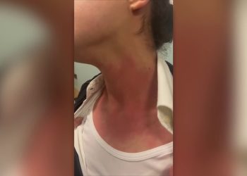 Norme più dure contro la violenza negli ospedali