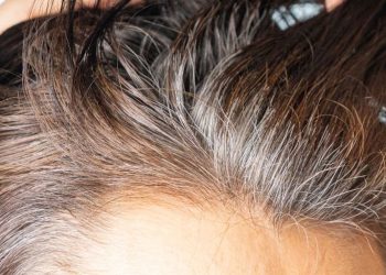 Perché i capelli diventano bianchi? Scopri le cause e i rimedi!