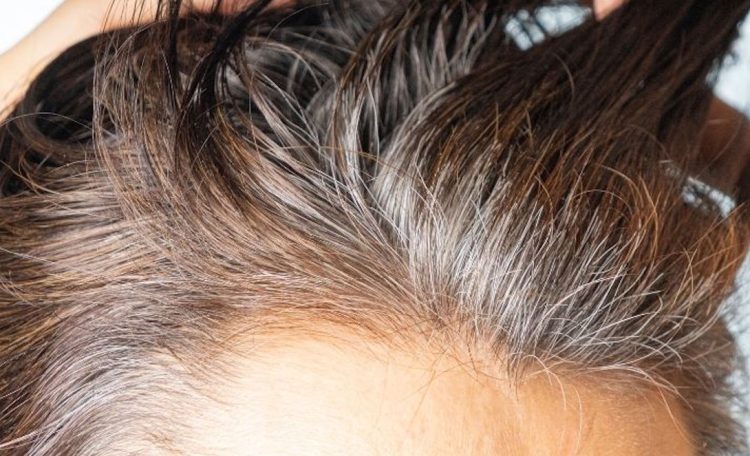 Perché i capelli diventano bianchi? Scopri le cause e i rimedi!