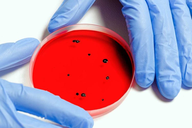 Cos'è la malattia mangiacarne e quali sono i sintomi? Ecco tutto quello che c'è da sapere