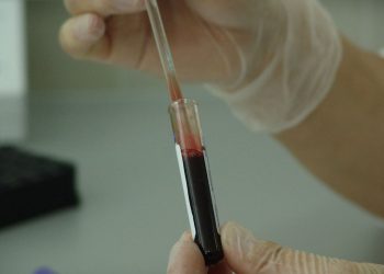 Uomo positivo al coronavirus della Mers, sconosciuta origine del contagio: 28enne in gravi condizioni