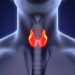 Ipertiroidismo: cos'è e sintomi