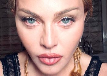 Madonna su Instagram: ho sentito tutto il vostro amore, sono sulla via del recupero