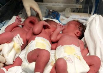 Tre gemelli per una coppia di Scicli: nati a Ragusa