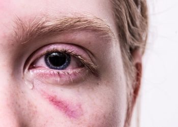 Violenza sessuale di gruppo a Palermo: arrestato il branco