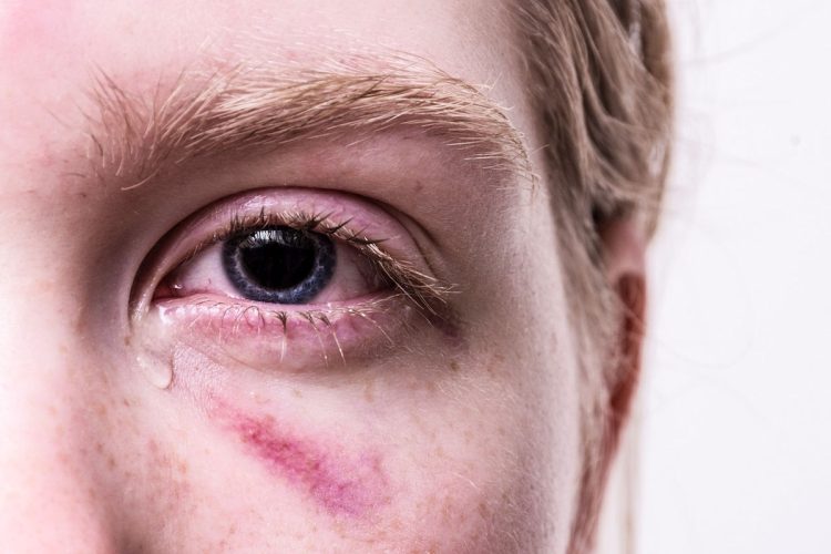 Violenza sessuale di gruppo a Palermo: arrestato il branco