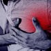 Infarto miocardico acuto: sintomi e cure