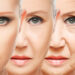 Come ringiovanire la pelle del viso senza medicina estetica