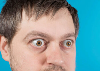 Esoftalmia, gli occhi sporgenti possono indicare un problema di salute?