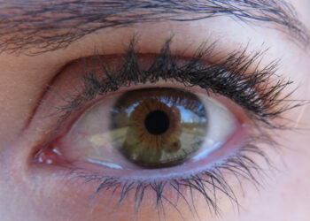 Perchè in inverno gli occhi lacrimano di più