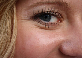 Cosa fa venire le rughe: scopri come prevenirle