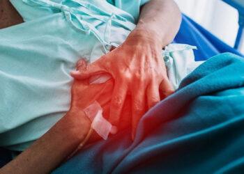 Calcolosi: cos'è e sintomi