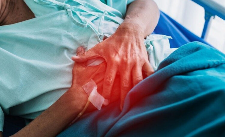 Calcolosi: cos'è e sintomi