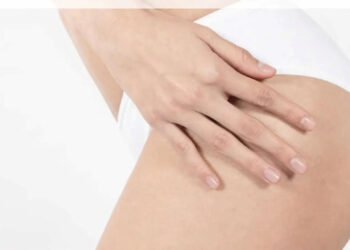 Cellulite, quanto ne sai veramente