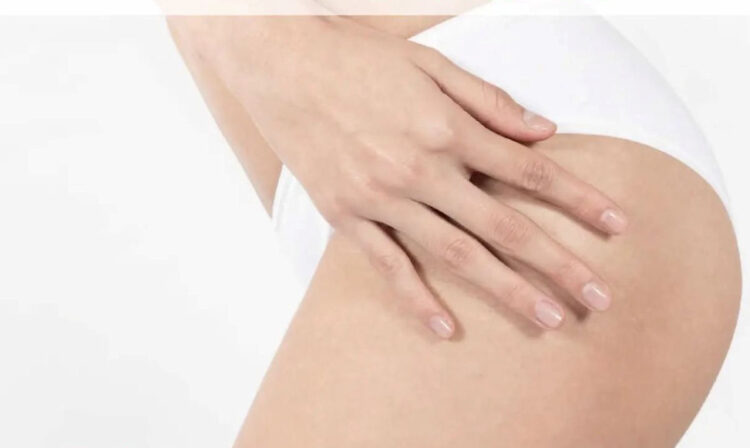 Cellulite, quanto ne sai veramente