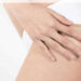 Cellulite, quanto ne sai veramente