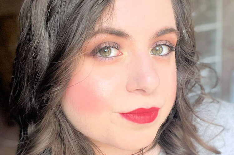 Simona Sturiale muore a 27 anni dopo intervento