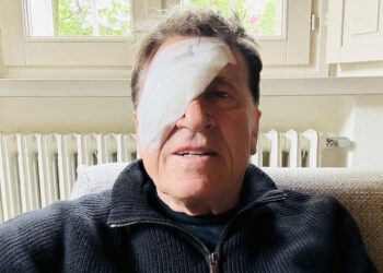 Gianni Morandi con l'occhio bendato: Ho fatto a pugni. Evviva