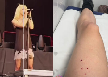 Pipistrello morde la cantante durante il concerto