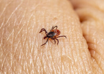 Meningoencefalite da zecche: sintomi e prevenzione