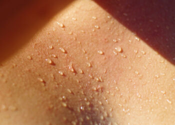 Pronto il cerotto smart: dal sudore monitora glucosio e vitamine