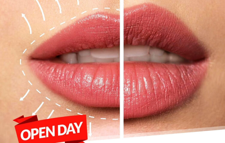 Labbra perfette rimpolpate naturalmente: open day a Ragusa