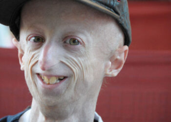 La lettera di Sammy Basso letta al suo funerale: amate chi vi sta accanto