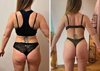 Glutei Alti e Sodi: I 6 errori da non commettere (e Come Risolvere)