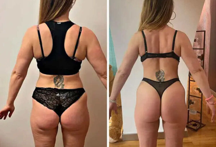 Glutei Alti e Sodi: I 6 errori da non commettere (e Come Risolvere)