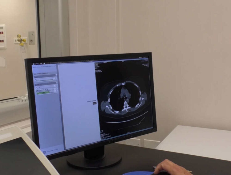 Tumore al polmone, diagnosticati tumori e inviati pazienti ai centri antifumo