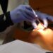 Bonus Dentista 2026: guida completa a requisiti, ISEE e modalità di accesso