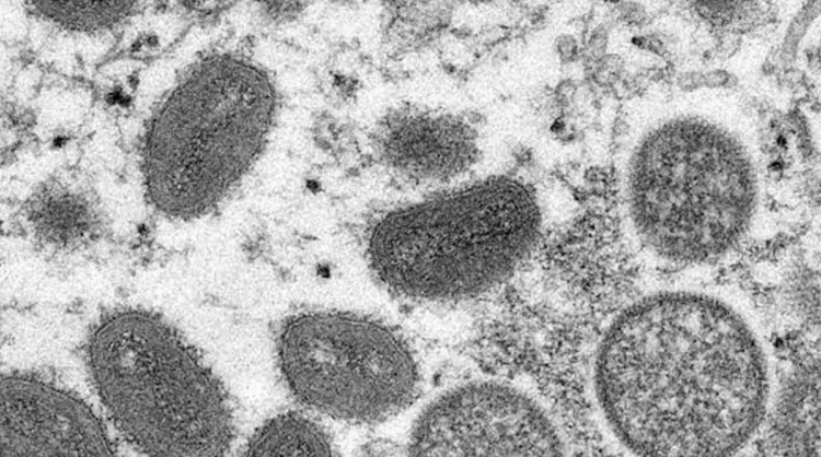 E' morto William Foege: il medico che cancello il vaiolo