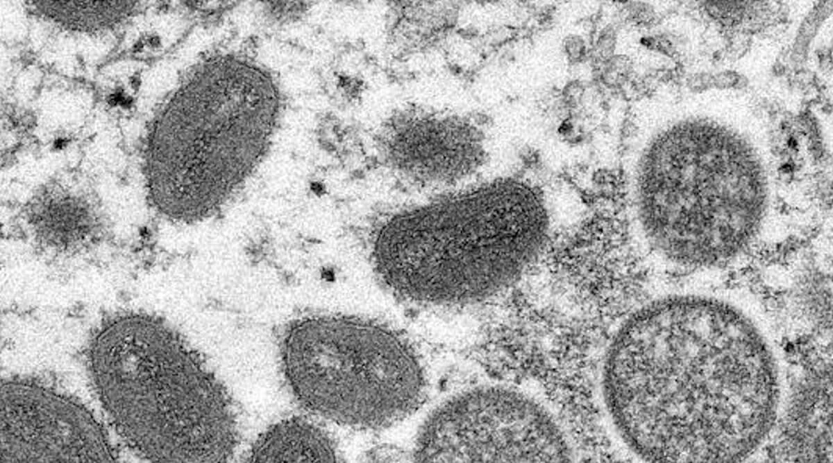 E’ morto William Foege: il medico che cancello il vaiolo