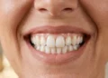 Donna con sorriso naturale e denti bianchi sani grazie a igiene orale corretta e sbiancamento dentale professionale