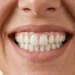Donna con sorriso naturale e denti bianchi sani grazie a igiene orale corretta e sbiancamento dentale professionale
