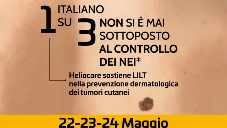 operatore sanitario controlla nei pelle tumori cutanei LILT prevenzione