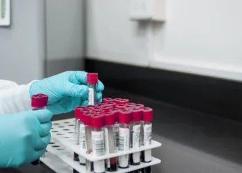 Provette di sangue in laboratorio per analisi del colesterolo