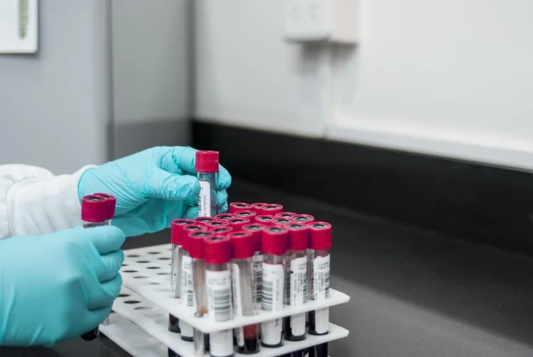 Provette di sangue in laboratorio per analisi del colesterolo