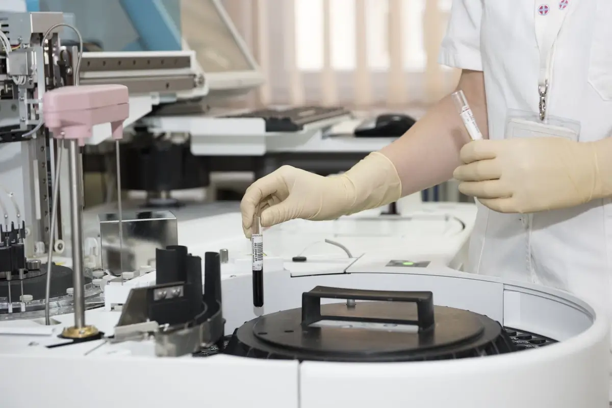 Mano guantata di un operatore sanitario preleva una provetta di sangue da un analizzatore automatico da laboratorio.