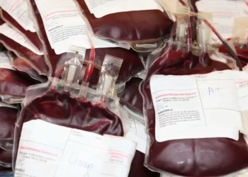 Sacche di sangue raccolte durante le donazioni, pronte per la trasfusione