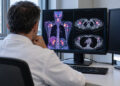 Scansione PET-TC del torace su un monitor per misurare il grasso bruno. Immagine generata con intelligenza artificiale