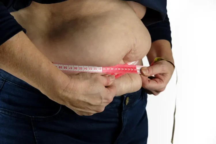 Persona obesa